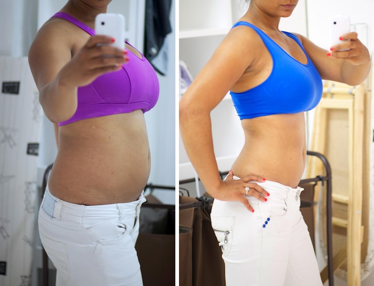 Antes e depois real de aluna 2 — evolução com as receitas e o Pilates na Cama