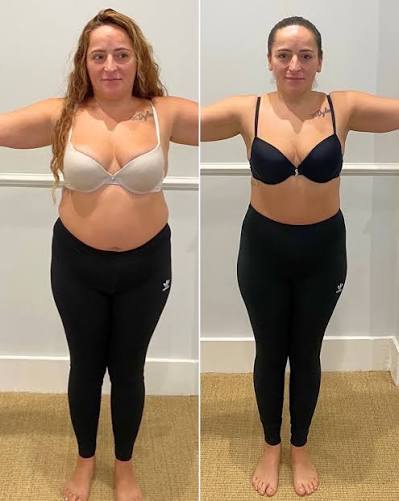 Antes e depois real de aluna 1 — evolução com as receitas e o Pilates na Cama